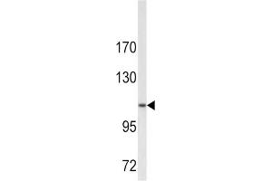 Western Blotting (WB) image for anti-Collagen, Type VI, alpha 1 (COL6A1) antibody (ABIN3002699)