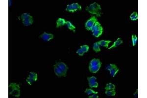 Immunofluorescence staining of PC-3 cells with ABIN7139863 at 1:50, counter-stained with DAPI. (GNG12 抗体  (AA 2-17))