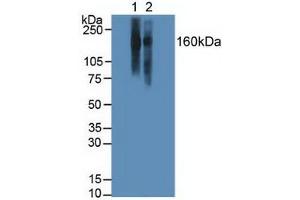 Western blot analysis of (1) Human Jurkat Cells and (2) Human Raji Cells. (ITGAL 抗体  (AA 809-1066))