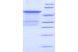 SDS-PAGE analysis of Mouse uPAR Protein. (PLAUR 蛋白)