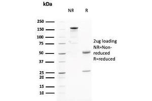 SDS-PAGE (SDS) image for anti-V-Akt Murine Thymoma Viral Oncogene Homolog 1 (AKT1) (AA 85-189) antibody (ABIN6939337)