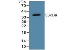 Detection of Recombinant DFFa, Human using Polyclonal Antibody to DNA Fragmentation Factor Subunit Alpha (DFFa) (DFFA 抗体  (AA 51-305))