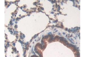 Detection of RI in Rat Lung Tissue using Polyclonal Antibody to Ribonuclease Inhibitor (RI) (RNH1 抗体  (AA 108-358))