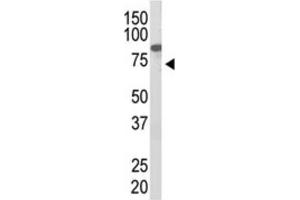 Western Blotting (WB) image for anti-Protein Inhibitor of Activated STAT, 2 (PIAS2) antibody (ABIN2996779)