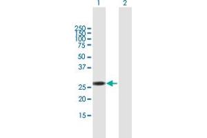 Western Blot analysis of RBM38 expression in transfected 293T cell line by RBM38 MaxPab polyclonal antibody. (RBM38 抗体  (AA 1-239))