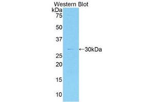 Western Blotting (WB) image for anti-Myosin IG (MYO1G) (AA 769-1016) antibody (ABIN1078399) (MYO1G 抗体  (AA 769-1016))