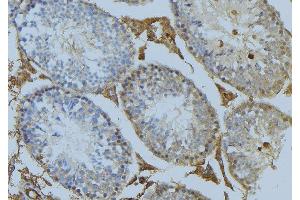 ABIN6274993 at 1/100 staining Mouse testis tissue by IHC-P. (CEP78 抗体  (Internal Region))