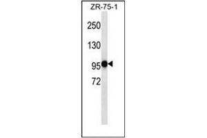 Western blot analysis of PHF14 Antibody (N-term) in ZR-75-1 cell line lysates (35ug/lane). (PHF14 抗体  (N-Term))