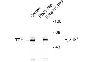 Western blots of rat brainstem lysate showing specific immunolabeling of the ~55k TPH protein phosphorylated at Ser260. (Tryptophan Hydroxylase 1 抗体  (pSer260))