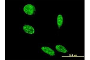 Immunofluorescence of monoclonal antibody to SAP18 on HeLa cell. (SAP18 抗体  (AA 1-153))