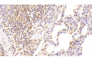 Detection of F2 in Human Lung Tissue using Monoclonal Antibody to Coagulation Factor II (F2) (Prothrombin 抗体)