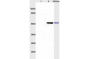Lane 1: rat liver lysates Lane 2: rat brain lysates probed with Anti CK12/Cytokeratin 12 Polyclonal Antibody, Unconjugated (ABIN872955) at 1:200 in 4 °C. (KRT12 抗体  (AA 151-250))