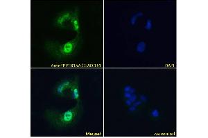 Immunofluorescence (IF) image for anti-Protein Phosphatase 1, Regulatory (Inhibitor) Subunit 15A (PPP1R15A) (C-Term) antibody (ABIN184571)