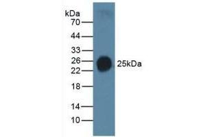 Detection of SP-C in Human Serum using Polyclonal Antibody to Surfactant Protein C (SP-C)