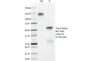 SDS-PAGE Analysis Purified p63 Mouse Monoclonal Antibody (TP63/11). (p63 抗体)