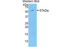 Western blot analysis of the recombinant protein. (TGM1 抗体  (AA 496-760))