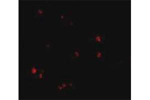 Immunofluorescence staining of human brain tissue with 20 ug/mL LASS5 polyclonal antibody . (LASS5 抗体  (C-Term))