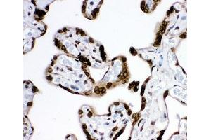 Immunohistochemistry (IHC) image for anti-Proteasome (Prosome, Macropain) 26S Subunit, Non-ATPase, 14 (PSMD14) (AA 362-632) antibody (ABIN3032352)