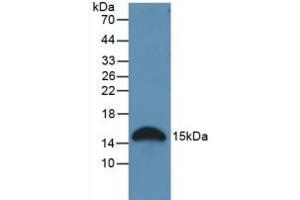 Detection of GAL2 in Rat Stomach Tissue using Polyclonal Antibody to Galectin 2 (GAL2) (Galectin 2 抗体  (AA 1-130))
