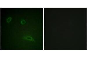 Immunofluorescence analysis of HeLa cells, using HER2 (Ab-1139) Antibody. (ErbB2/Her2 抗体  (AA 1111-1160))