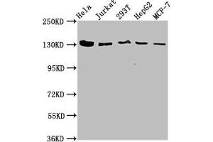 Western Blot Positive WB detected in: Hela whole cell lysate, Jurkat whole cell lysate, 293T whole cell lysate, HepG2 whole cell lysate, MCF-7 whole cell lysate All lanes: CAND1 antibody at 4. (CAND1 抗体  (AA 1150-1230))