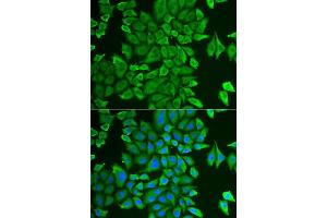 Immunofluorescence analysis of HeLa cells using APEH antibody. (APEH 抗体  (AA 1-260))