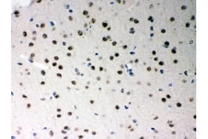 Immunohistochemistry (IHC) image for anti-serine/arginine-Rich Splicing Factor 1 (SRSF1) (AA 6-33), (N-Term) antibody (ABIN3043296)