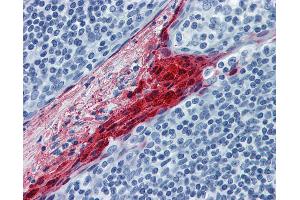 Anti-SPRR3 antibody IHC of human tonsil. (SPRR3 抗体  (AA 1-162))