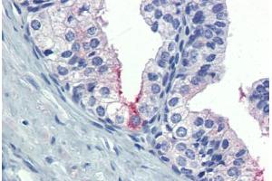 Prostate: Formalin-Fixed, Paraffin-Embedded (FFPE) (AMH 抗体  (AA 468-517))