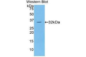 Western Blotting (WB) image for anti-Protein Kinase C, eta (PRKCH) (AA 355-614) antibody (ABIN1860237) (PKC eta 抗体  (AA 355-614))