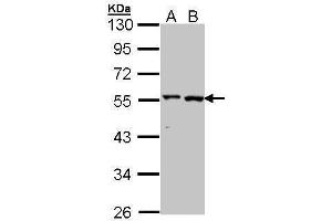 WB Image Sample (30 ug of whole cell lysate) A: A431 , B: Hela 10% SDS PAGE antibody diluted at 1:1000 (ALT 抗体  (N-Term))