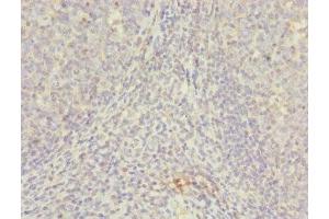 Immunohistochemistry of paraffin-embedded human tonsil tissue using ABIN7145623 at dilution of 1:100 (NUDT2 抗体  (AA 1-147))