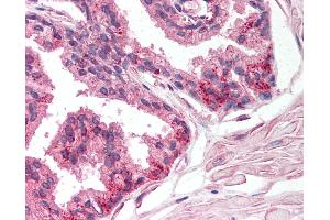 Immunohistochemistry (IHC) image for anti-Prostaglandin I2 (Prostacyclin) Synthase (PTGIS) (AA 299-329) antibody (ABIN2451653)