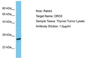 Host: Rabbit Target Name: ORC6 Sample Type: Thyroid Tumor lysates Antibody Dilution: 1. (ORC6 抗体  (N-Term))