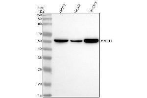 Western blot analysis of MMP11 using anti-MMP11 antibody (ABIN7605573).