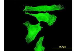 Immunofluorescence of monoclonal antibody to TAOK3 on HeLa cell. (TAO Kinase 3 抗体  (AA 809-898))