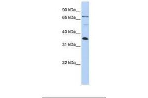 Image no. 1 for anti-LIM and SH3 Protein 1 (LASP1) (AA 182-231) antibody (ABIN6738999) (LASP1 抗体  (AA 182-231))