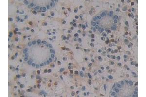 Detection of MCP4 in Human Stomach Tissue using Polyclonal Antibody to Monocyte Chemotactic Protein 4 (MCP4) (CCL13 抗体  (AA 24-98))
