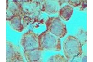 Image no. 2 for anti-Distal-Less Homeobox 3 (DLX3) (AA 220-270) antibody (ABIN960137) (DLX3 抗体  (AA 220-270))