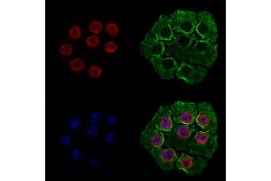 ABIN6262331 and ABIN6277975 staining HepG2 cells by IF/ICC. (HNRNPUL1 抗体  (C-Term))