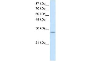 PRKRA antibody used at 1 ug/ml to detect target protein. (PRKRA 抗体  (Middle Region))