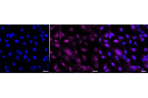 Immunocytochemical staining of C2C12 cells with IL33 antibody (ABIN7799107), 1:1,000).