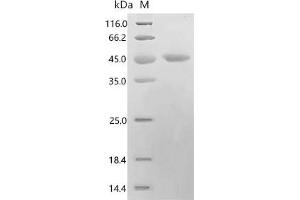 (Tris-Glycine gel) Discontinuous SDS-PAGE (reduced) with 5 % enrichment gel and 15 % separation gel.
