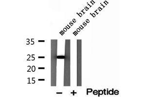 Western blot analysis of extracts of mouse brain tissue, using IFT25 antibody. (HSPB11 抗体  (N-Term))
