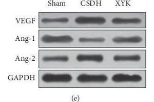 In the XYK group, HIF-1α and VEGF decreased, E3 ubiquitin-protein ligase parkin and 26S proteasome protein increased, and the Ang-1/Ang-2 ratio increased in the hematoma. (VEGFA 抗体  (AA 27-190))