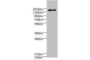 Western blot All lanes: CR1 antibody at 3. (CD35 抗体  (AA 420-550))
