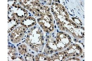 Immunohistochemical staining of paraffin-embedded liver tissue using anti-TTLL12mouse monoclonal antibody. (TTLL12 抗体)