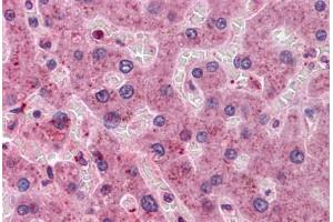 Human Liver: Formalin-Fixed, Paraffin-Embedded (FFPE) (HYI 抗体  (AA 1-218))