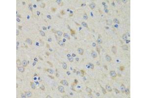 Immunohistochemistry (Paraffin-embedded Sections) (IHC (p)) image for anti-RAE1 RNA Export 1 Homolog (S. Pombe) (RAE1) antibody (ABIN7262609)