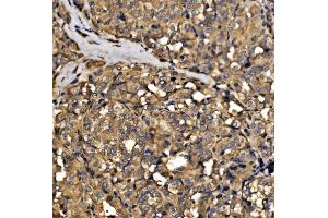 IHC analysis of SRP72 using anti-SRP72 antibody (ABIN7601648). (SRP72 抗体  (AA 40-460))